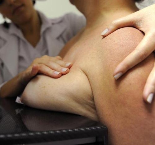 Quase 14 mil mulheres fizeram mamografias no SUS dos três maiores municípios da Serra em 2018