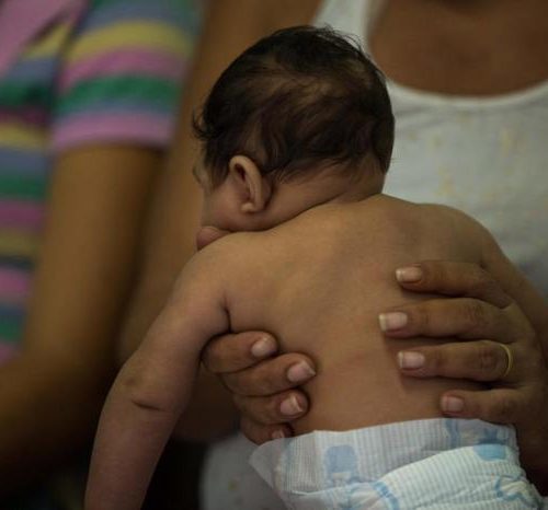 Mortalidade infantil no país é três vezes maior entre bebês com microcefalia