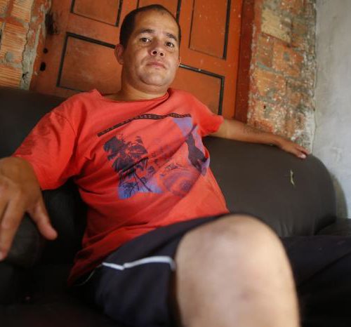 Tempo médio de espera por próteses dentárias via SUS na Capital é de 424 dias