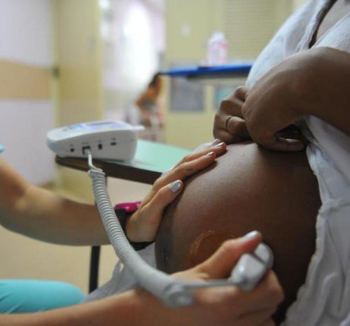 Projeto que permite cesárea sem indicação no SUS é aprovado em SP