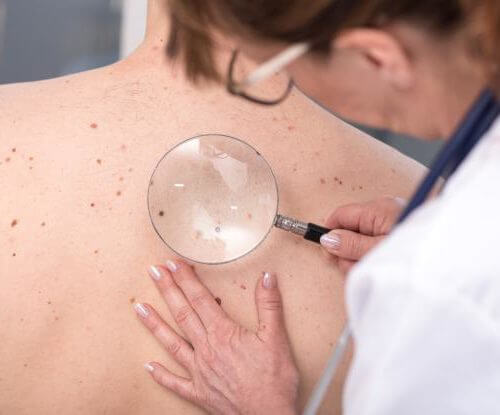 Consulta pública sobre tratamentos modernos para o câncer de pele no SUS está aberta à população