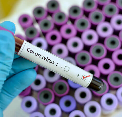 Saúde investe no acompanhamento de pessoas que tiveram contato com casos de Covid-19