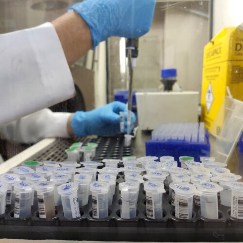 Laboratório da Santa Casa completa 10 anos e atinge mais de 40 mil exames de PCR para Covid
