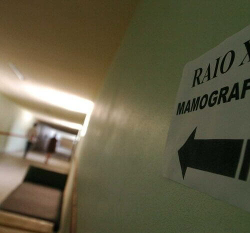 978698_ff87fe0fb3b08d7 Pandemia reduziu pela metade as mamografias, mas procura por médicos tem crescido