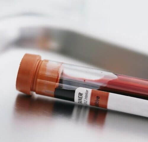 Medicamento usado na reposição de anticorpos e no tratamento pós-covid permanece escasso em hospitais de Porto Alegre