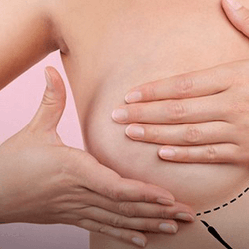 autoexame_cancer_de_mama Campanha Quanto Antes Melhor alerta para prevenção ao câncer de mama