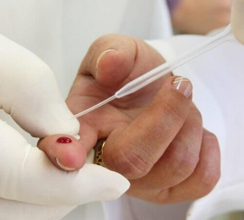 Cartilha incentiva retomada de ações de prevenção a IST/HIV e Hepatites Virais