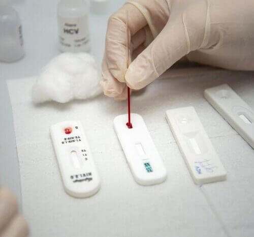 Senado aprova projeto que garante o sigilo sobre pessoas com HIV, hepatites crônicas, hanseníase e tuberculose
