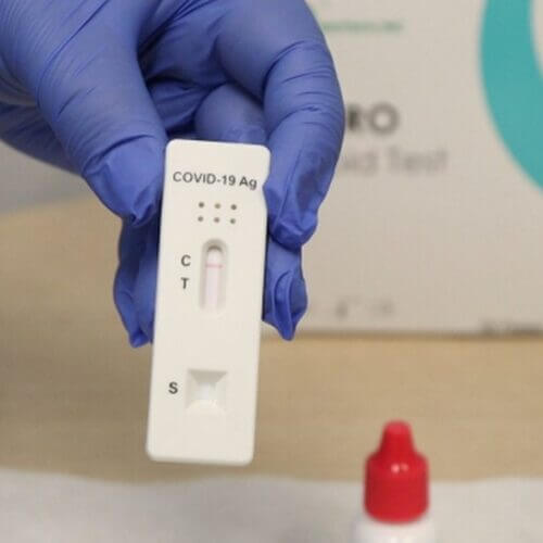 ANS publica resolução sobre testes rápidos da Covid nos planos de saúde; veja como vai funcionar